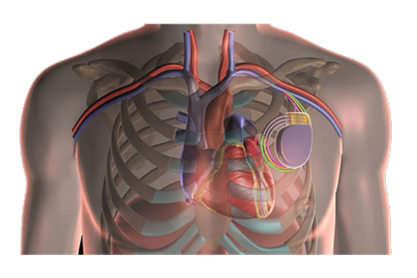 heart failure treatment