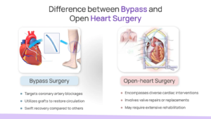 cabg-and-open-heart-surgery