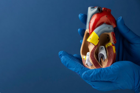 Open Heart Surgery (CABG)