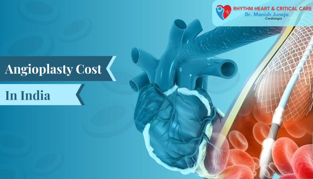 Angioplasty Cost in India (Guide 2026)