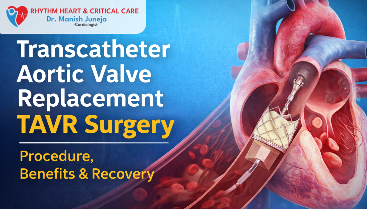 Transcatheter Aortic Valve Replacement TAVR Surgery
