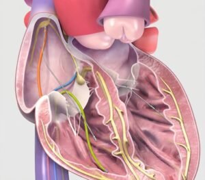 Diagnostic Electrophysiology Studies treatment