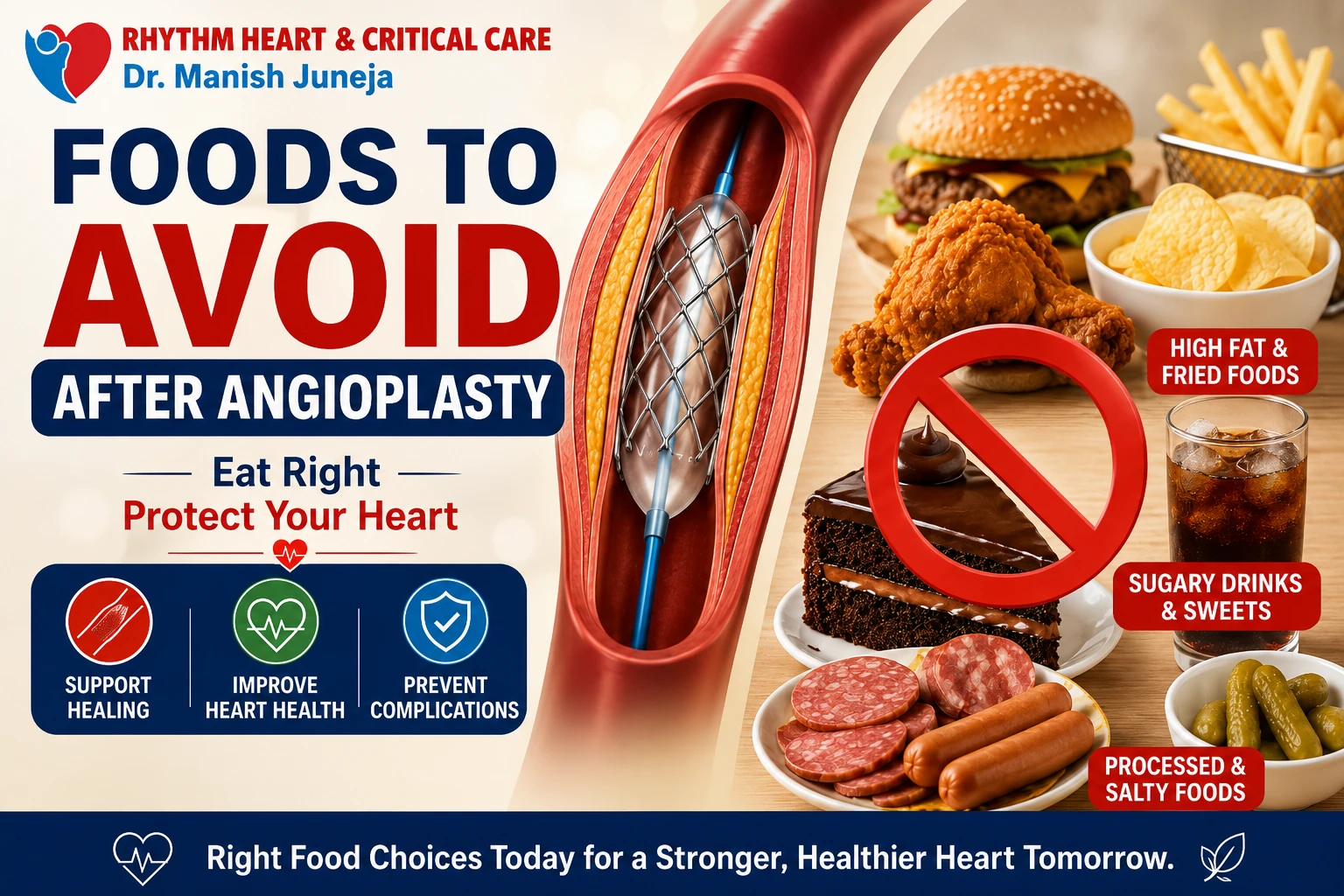 Foods to Avoid After Angioplasty
