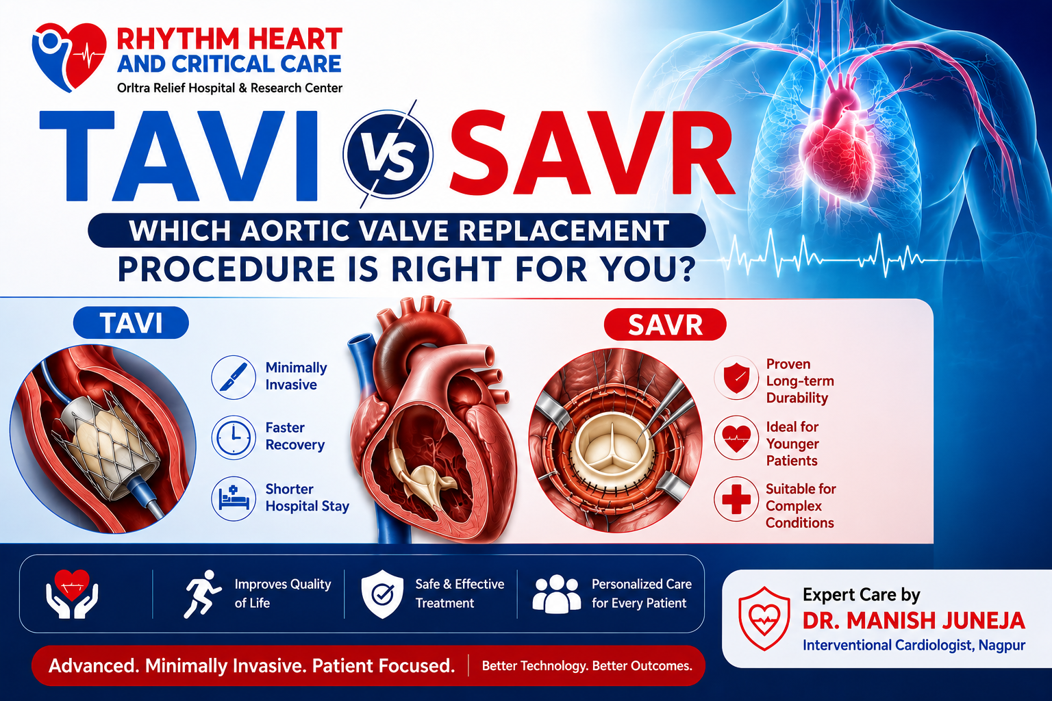 Tavi vs Savr